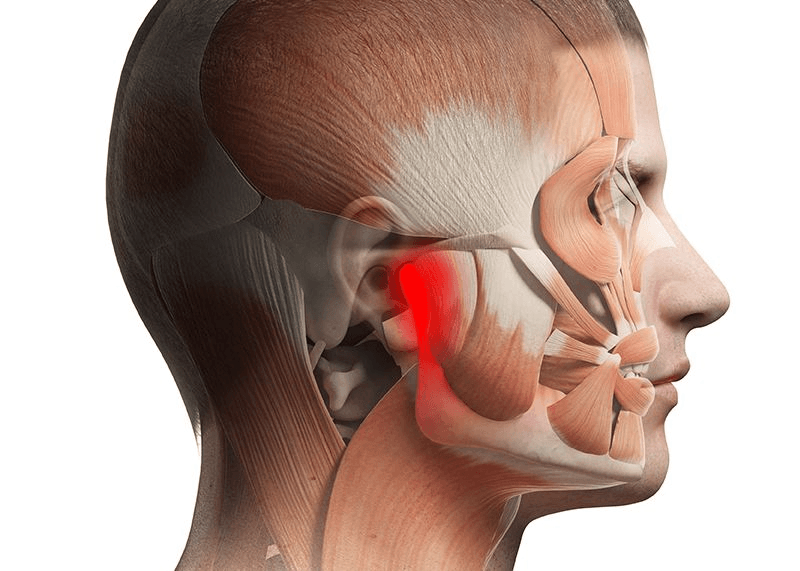 TMJ jaw pain treatment at Lebanon Dental Studio