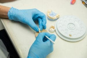 Dental lab technician crafting a full-arch prosthetic for All-on-4 restoration