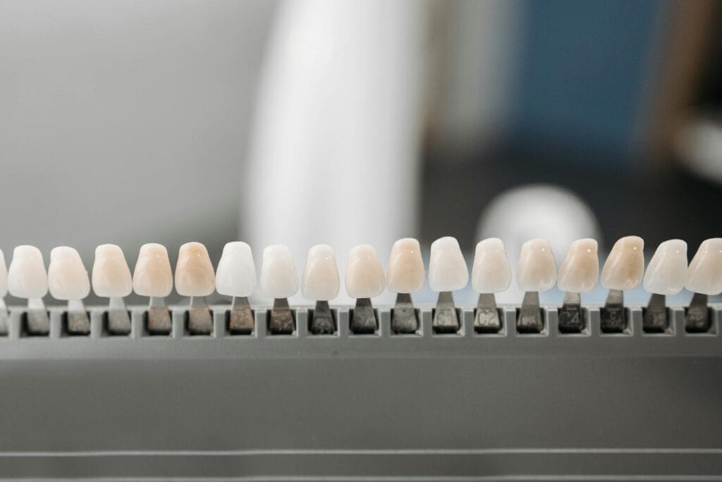 Dental veneer shells on display showing zirconia and E.max material options