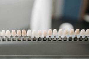 Dental veneer shells on display showing zirconia and E.max material options